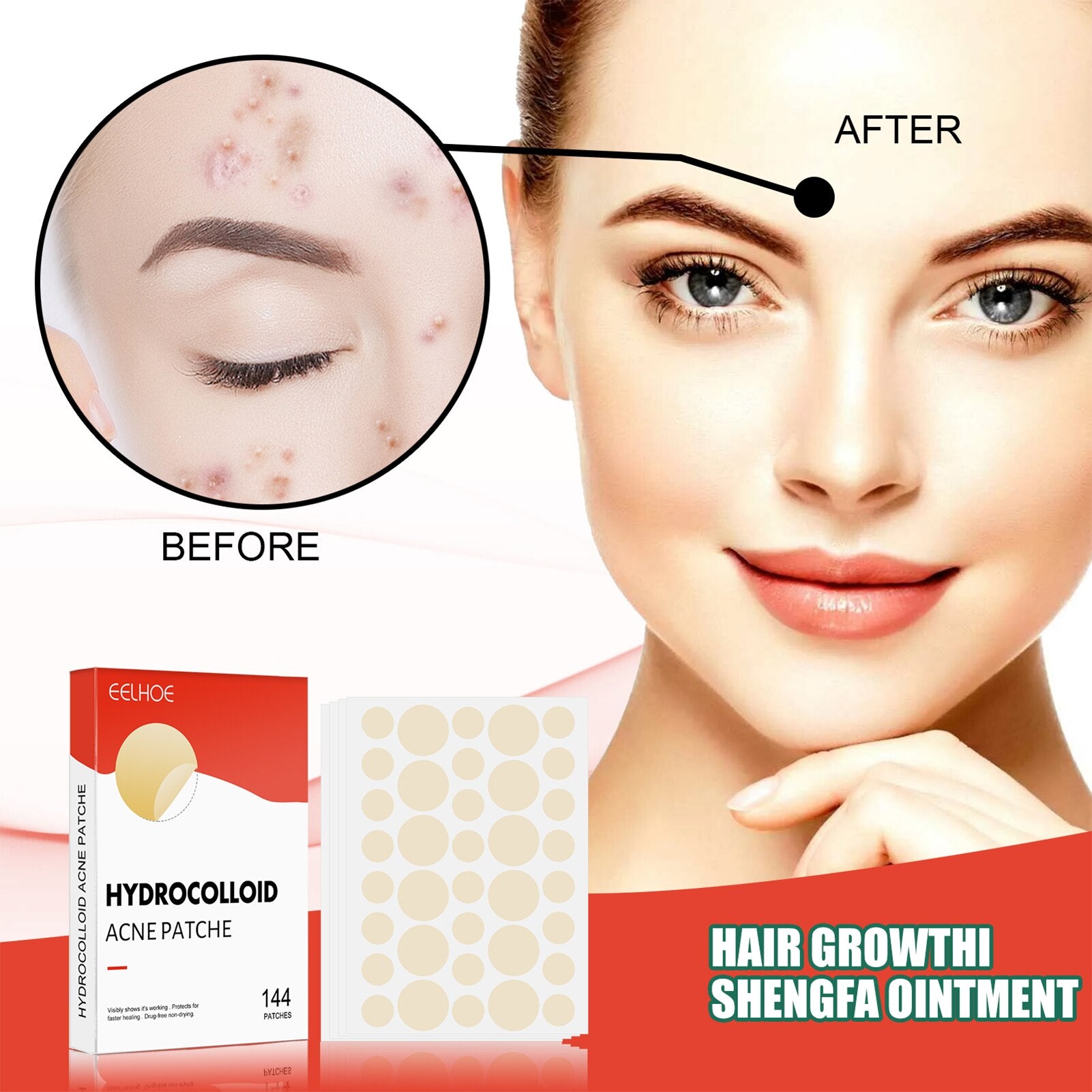 Hydrocolloid Acne Patch