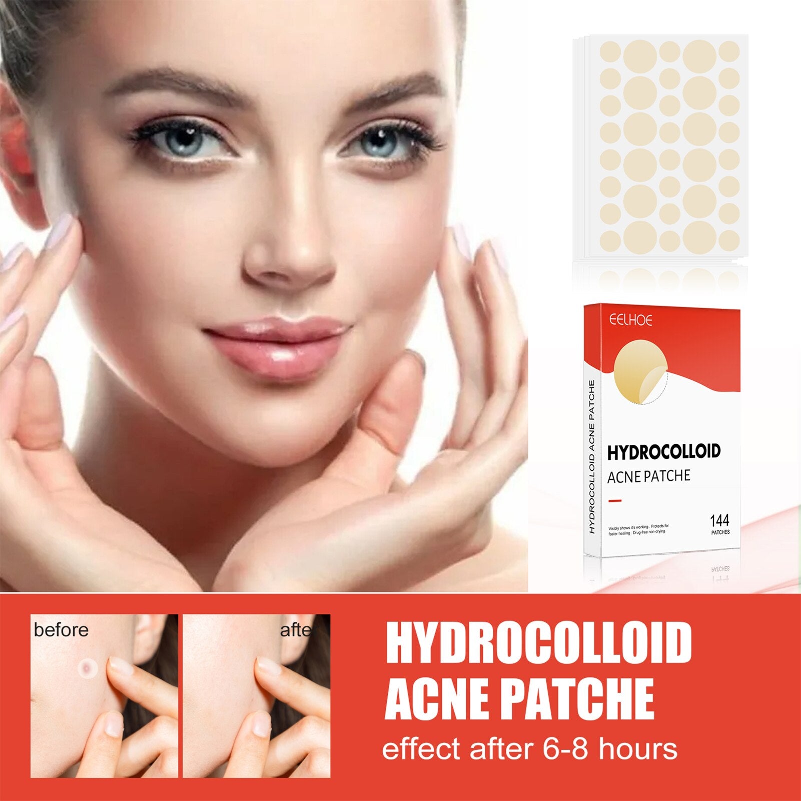 Hydrocolloid Acne Patch